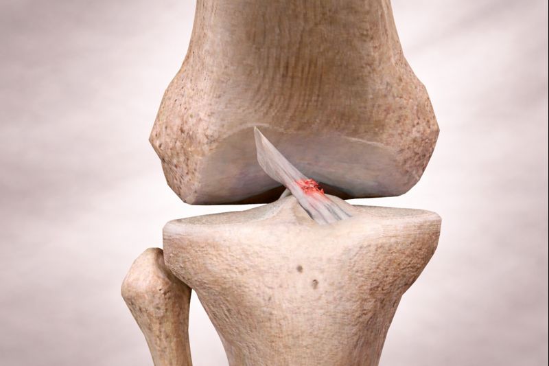 lesion du ligament croise