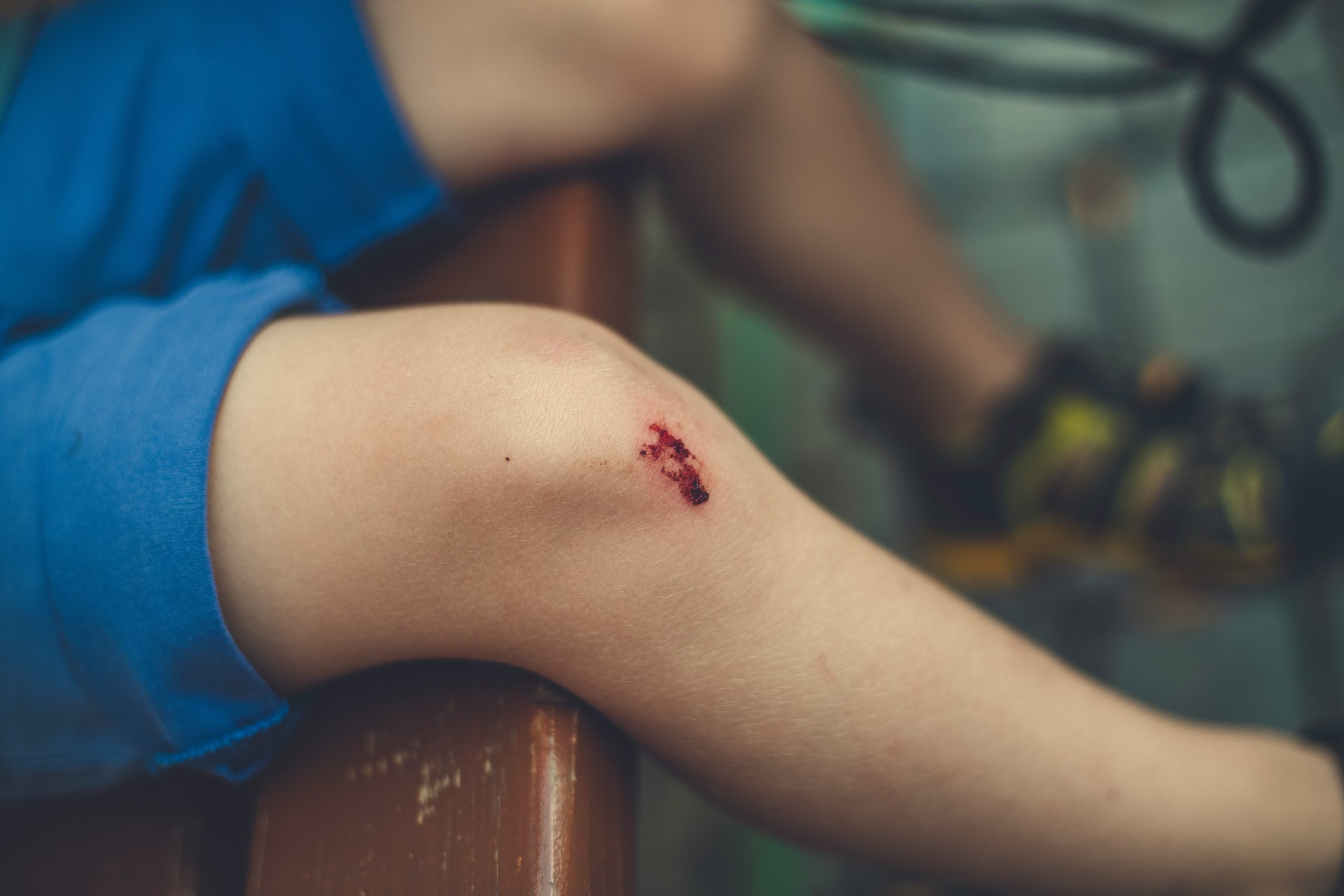 douleur au genou apres une chute