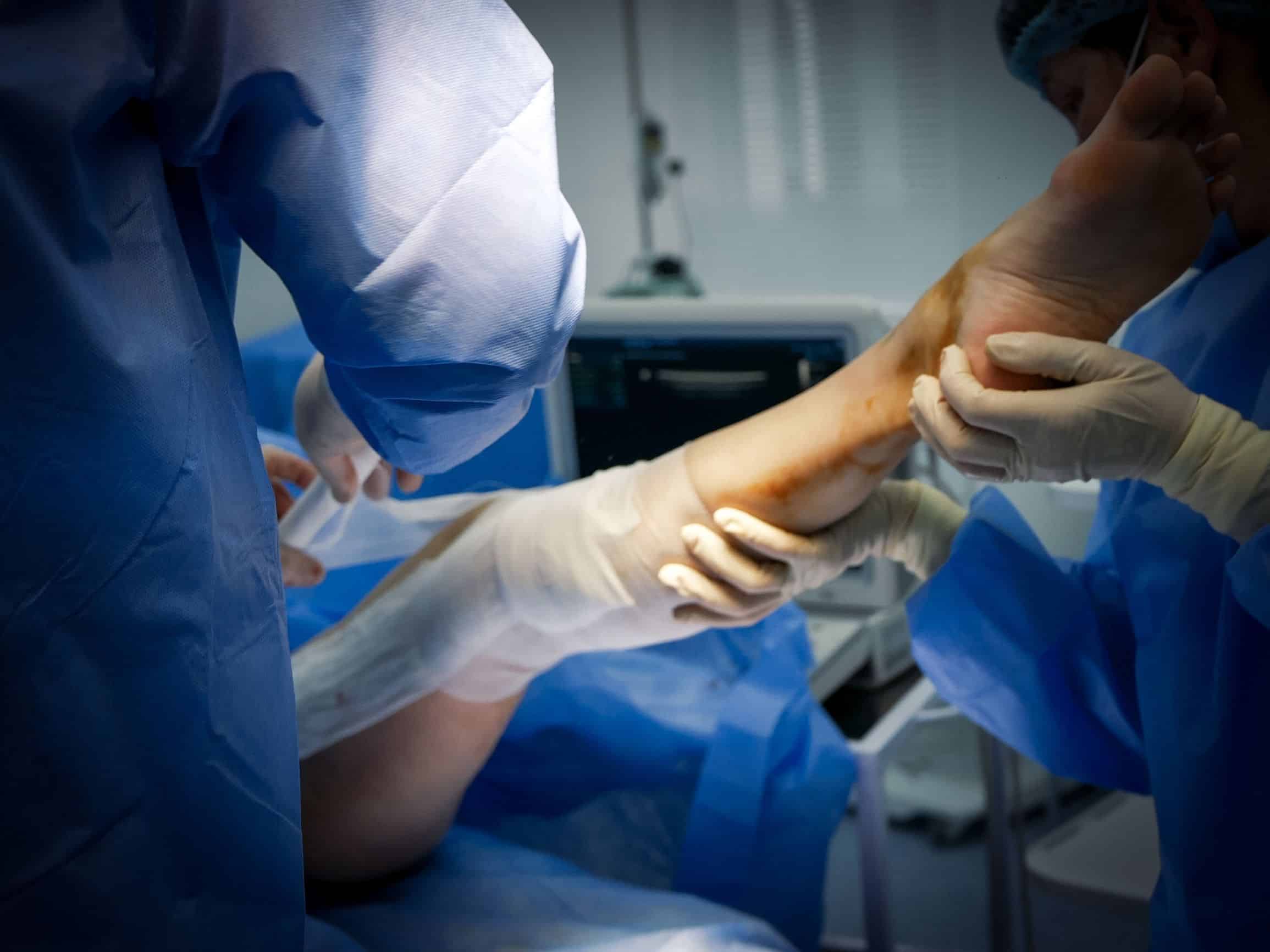 chirurgie du genou
