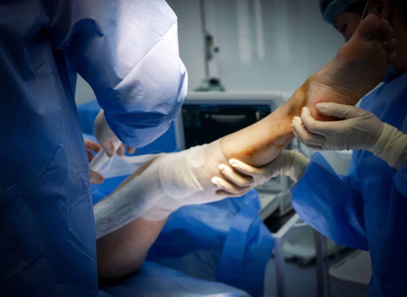 chirurgie du genou